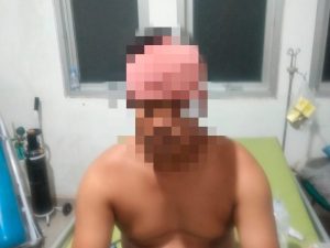 Korban penganiayaan. (Dok. Polsek Muara Kaman)